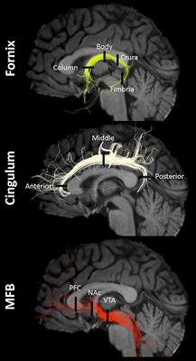 Affective Circuitry Alterations in Patients with Trigeminal Neuralgia